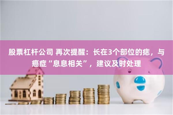 股票杠杆公司 再次提醒：长在3个部位的痣，与癌症“息息相关”，建议及时处理